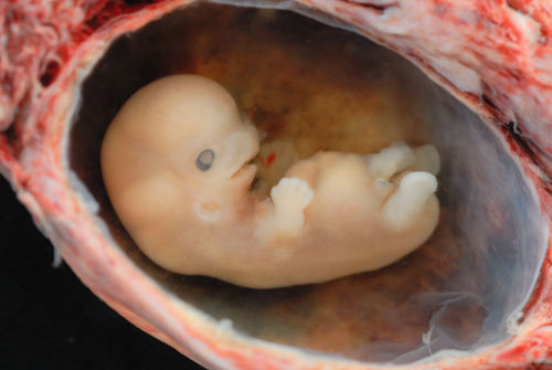 fetus.JPG