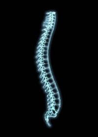 spine-xray-772334.jpg